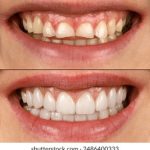 博乐彩票国际:探索全球彩票市场的新机遇与挑战 5jkjcrps6